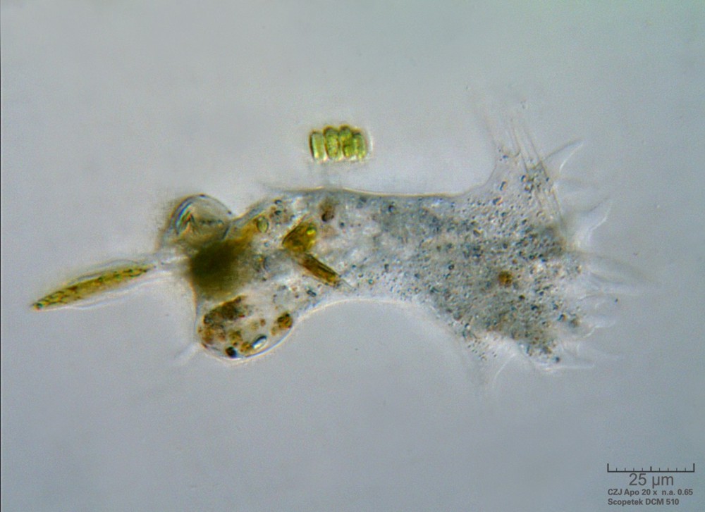 Amoeba (affamatissima!)